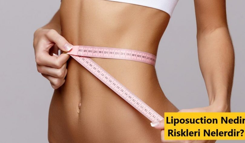  Liposuction Nedir? Yağ Aldırma Öncesi Sonrası Fiyatları